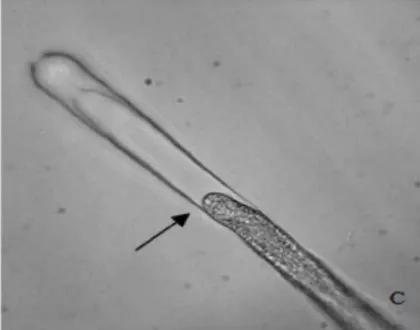 水产养殖霉菌怎么处理,水产养殖杀水霉方法