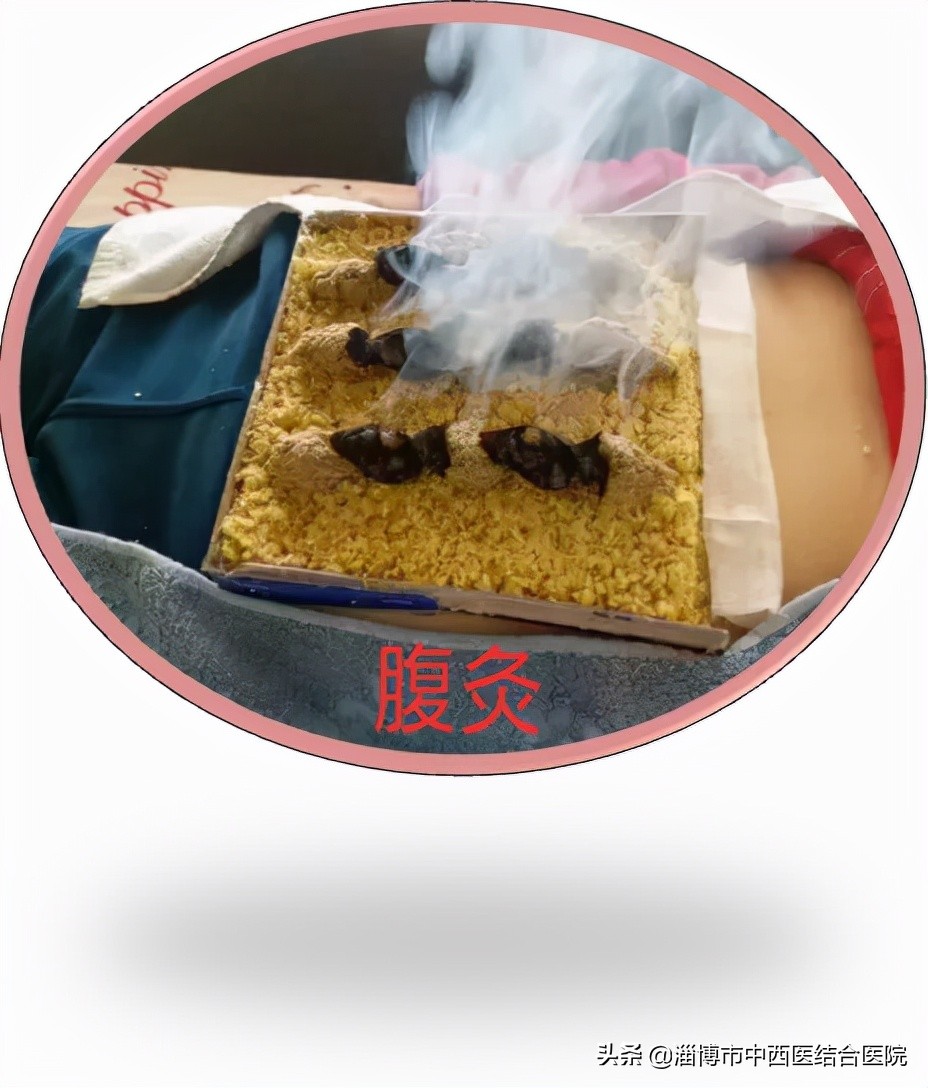 【头雁领航】山东省中医药临床重点专科—淄博市中西医结合医院针灸科