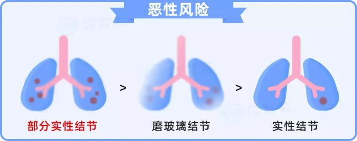 90后投保哪款保险比较适宜,可以带病投保的保险推荐