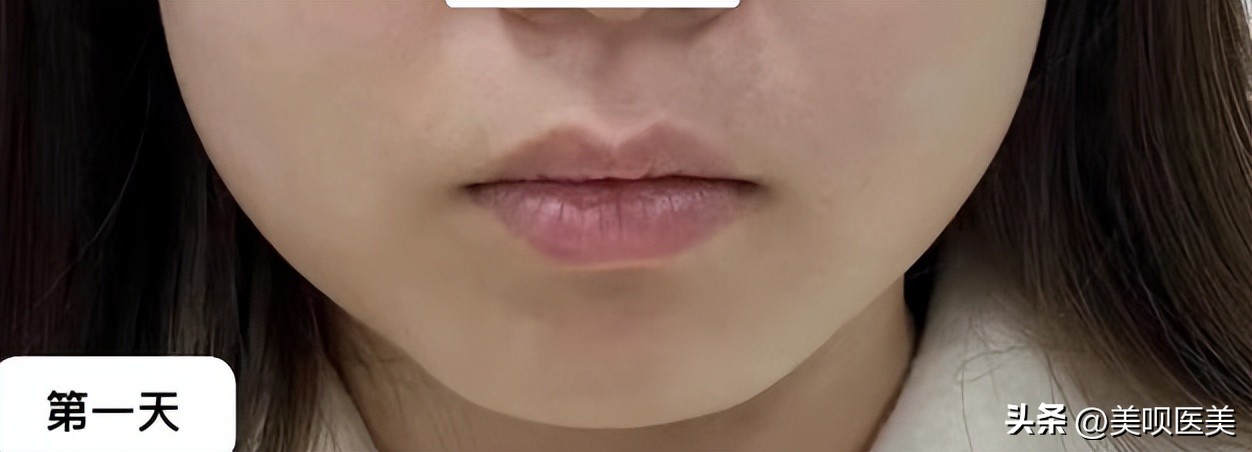 女明星都逃不过的颈纹,女明星也逃不过的身材缺陷