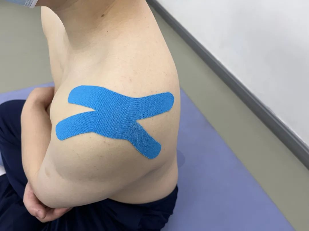 肌效贴颈椎使用方法图解,肩膀疼肌内效贴使用方法