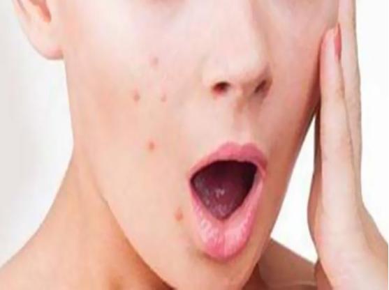 甲硝唑相当功效的药,阿莫西林加甲硝唑可以治疗什么病