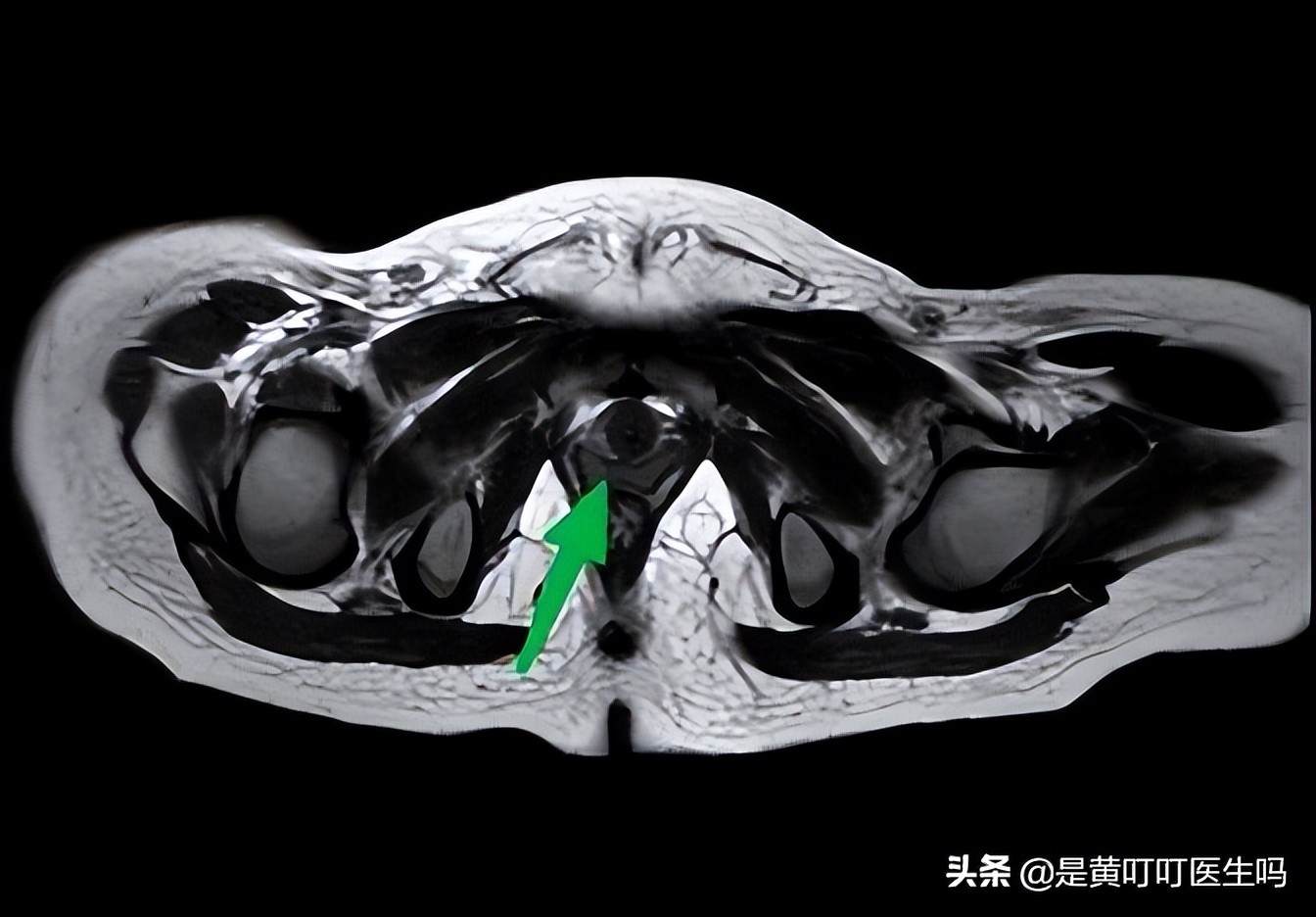 健康科普女生,科普女性健康体检
