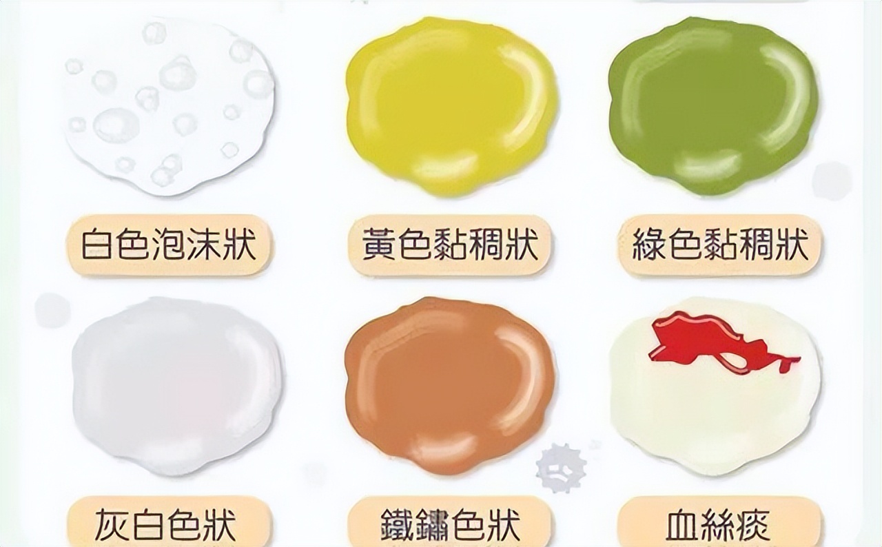 痰是肺部健康的信号，咳出黑痰、黄痰、白痰分别意味着什么？