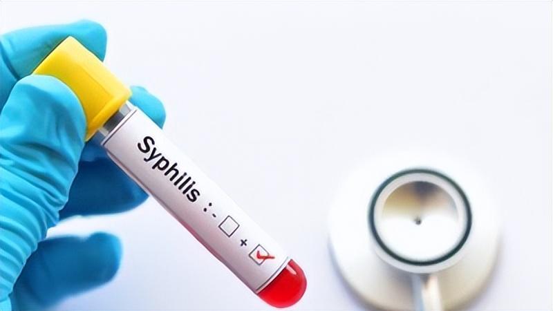 梅毒潜伏性,梅毒能在身体里潜伏几年没有症状