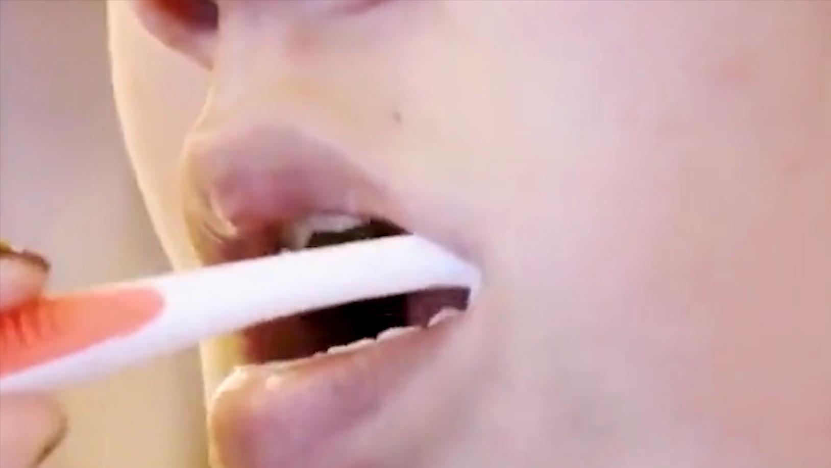 云南男子口臭手术后现在怎么样了,云南男子口臭查出了大毛病