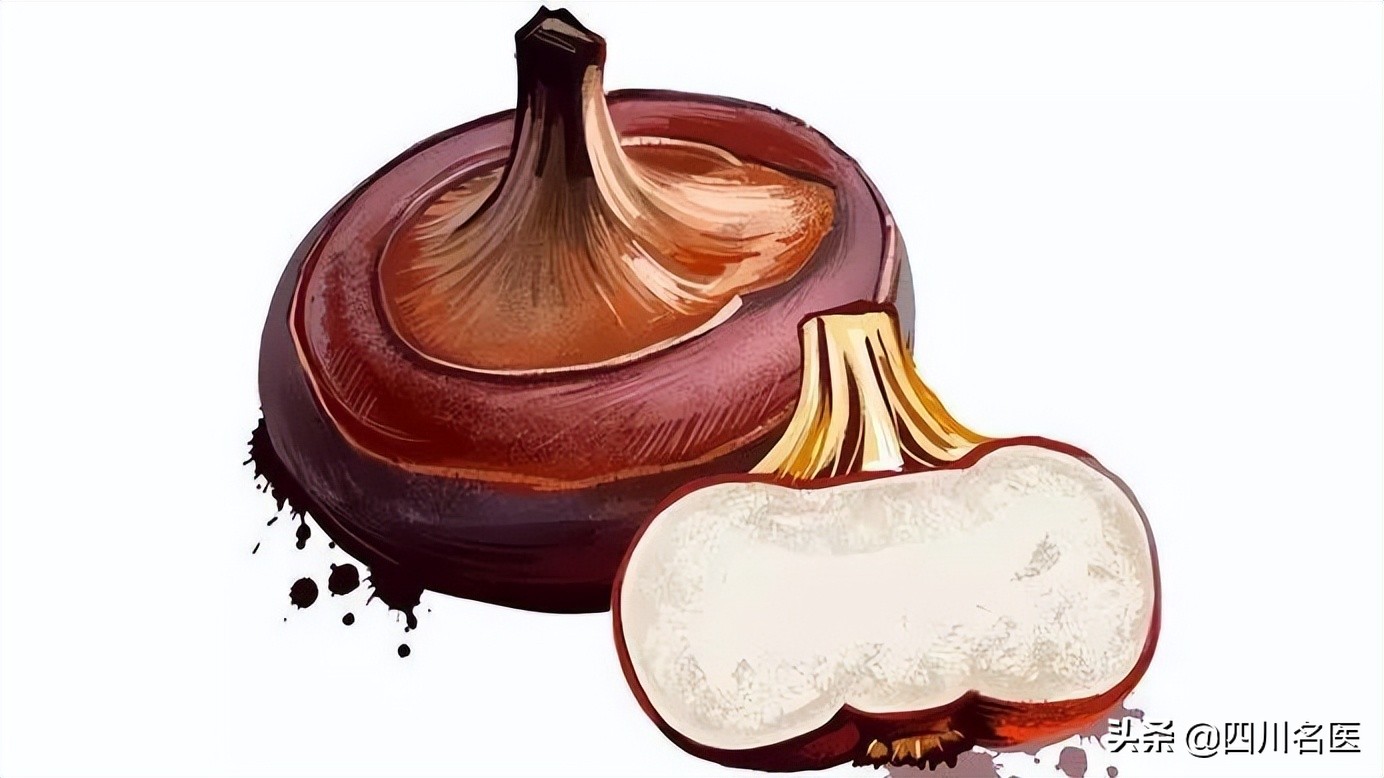 四川女子大脑吃出虫子,四川最易感染的寄生虫