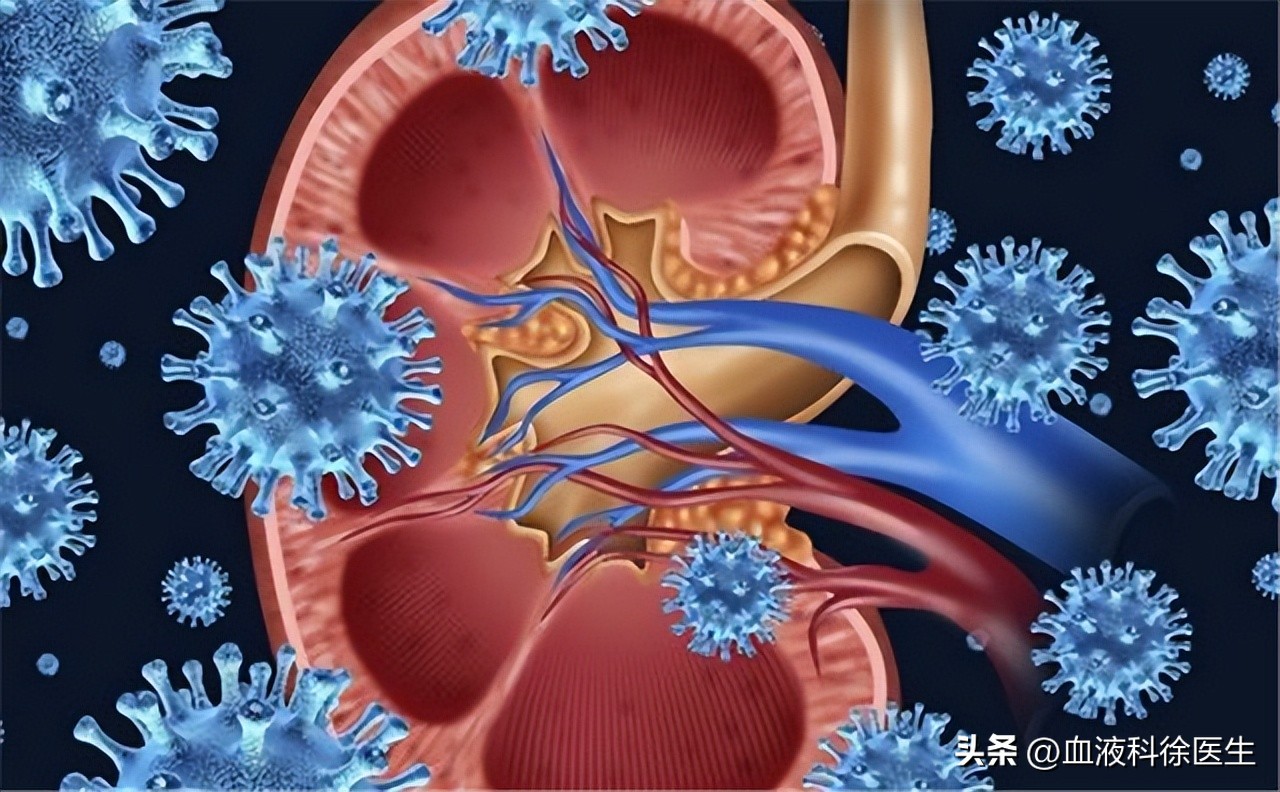 体检出肾结石怎么去医院问诊,体检检查出肾结石怎么处理