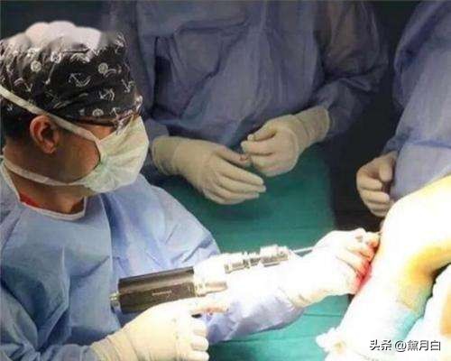 断骨增高中国第一人现状,小伙花16万断骨长高