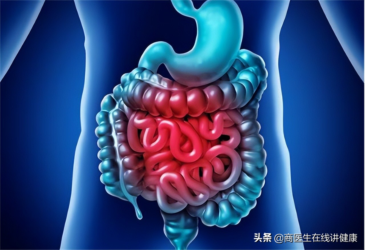 为什么肠道老是长息肉,为什么会有肠道息肉