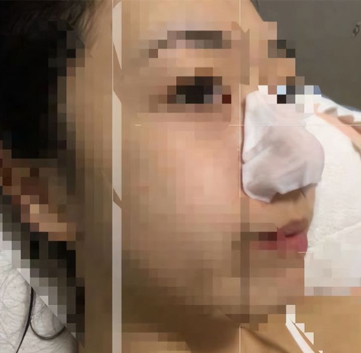 20年的黑头有多大,世界上最长的黑头到底有多长