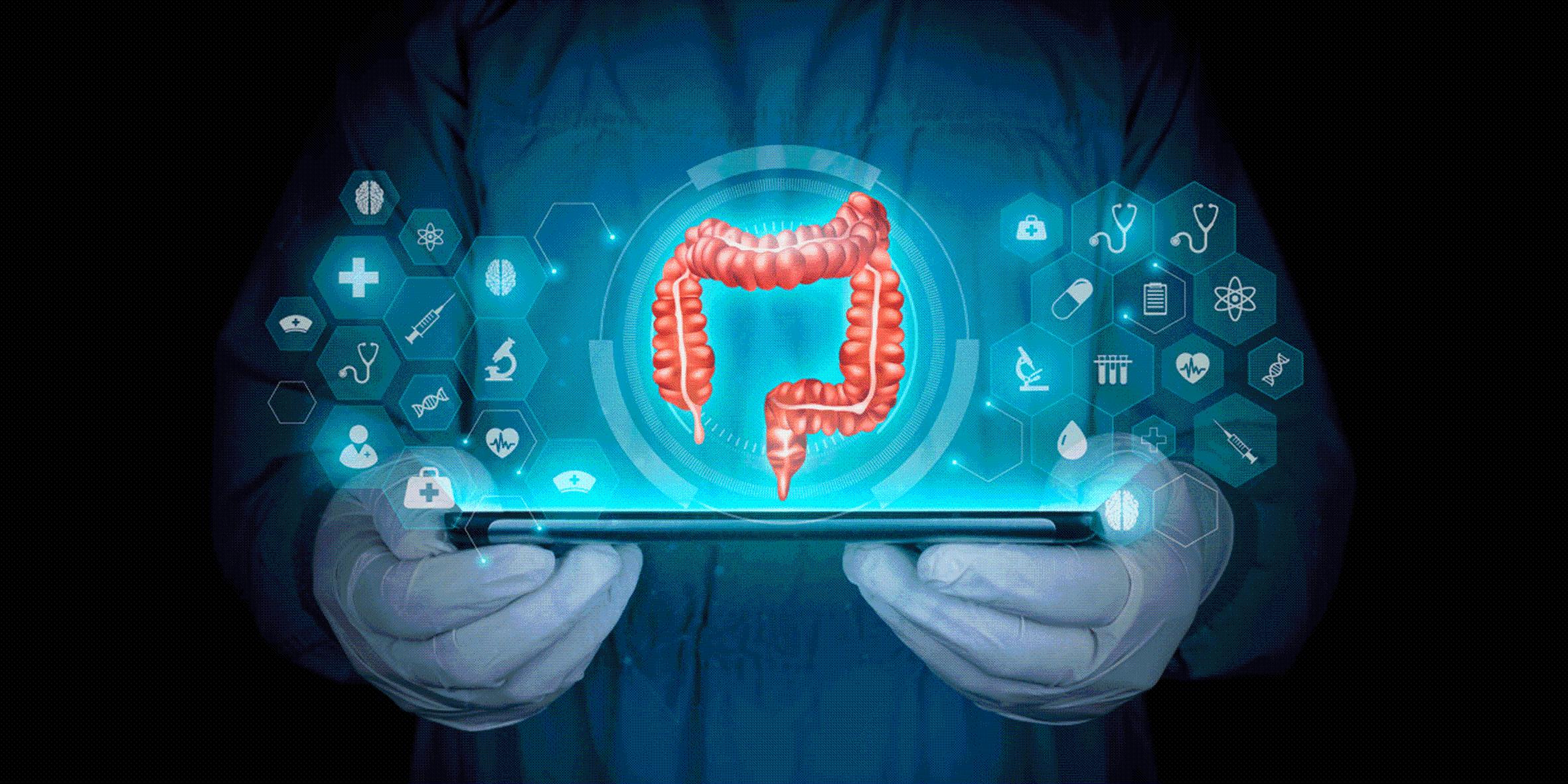 腾讯出手！肠镜筛查辅助软件添新选