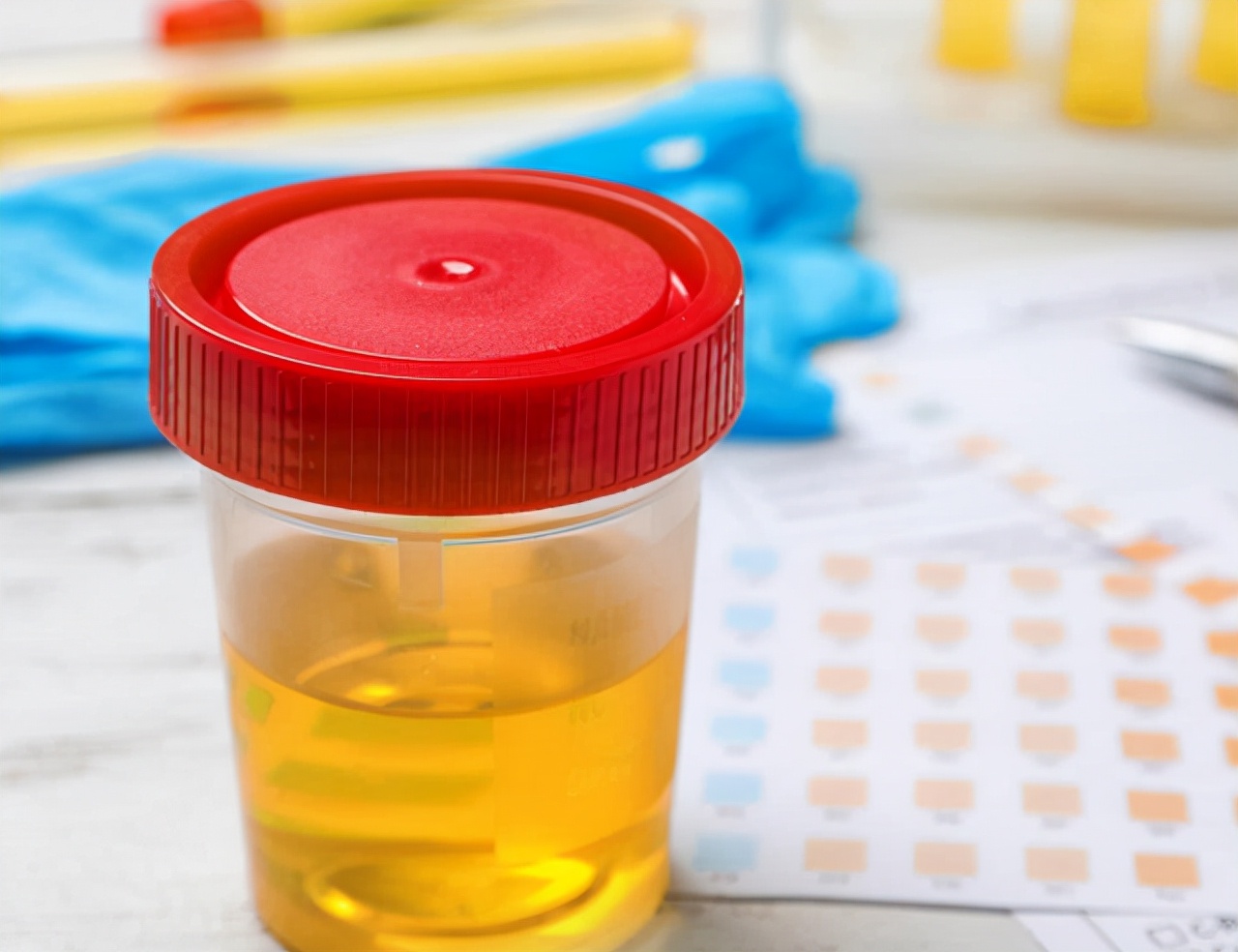 上厕所尿液偏黄是上火了吗,上厕所尿液黄是怎么回事