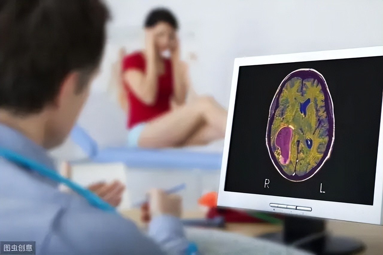 为何现在脑胶质瘤特别多,你对脑胶质瘤了解多少