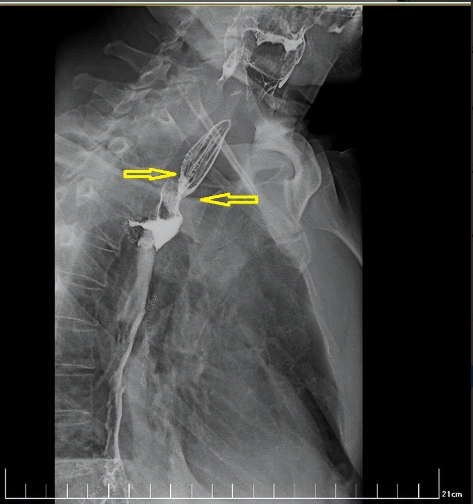 西安国际医学中心磁波刀,西安市国际医学中心肿瘤手术