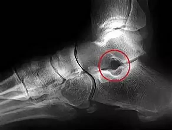 解剖基础知识,解剖基础知识教程60集