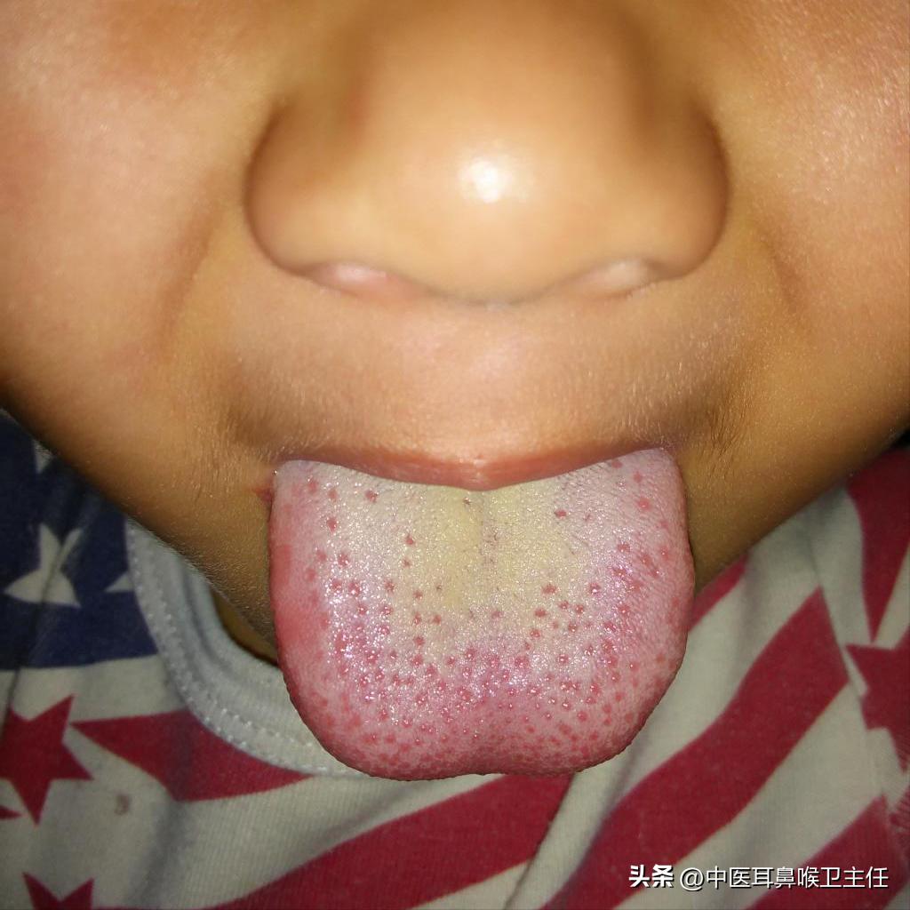 积食咳嗽：白天不咳，一睡觉就猛咳不止，说说如何干预和调理