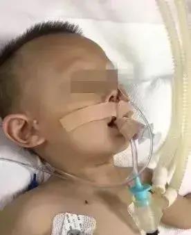 当心肺部疾病,肺坏死有生命危险吗