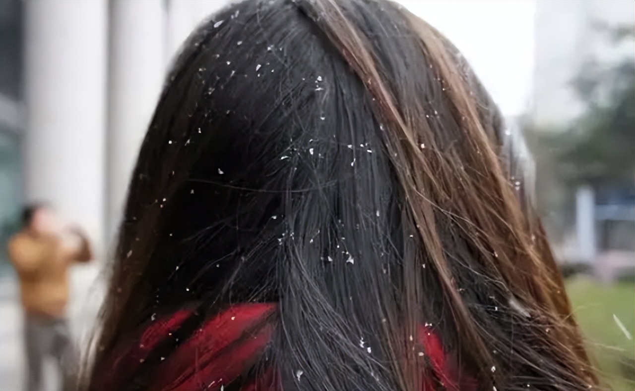 头皮上长红疙瘩脓包头皮屑特别多,头皮总是长疙瘩或脓包是什么原因