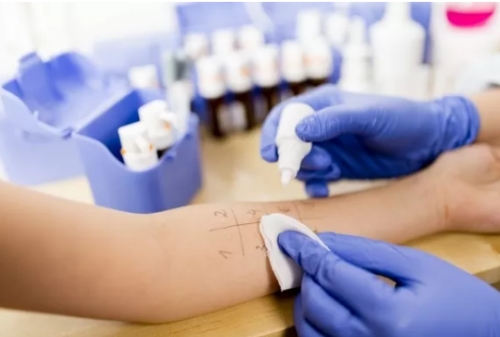 皮肤过敏怎么才能提高抗过敏能力,皮肤过敏吃几天过敏药可以好