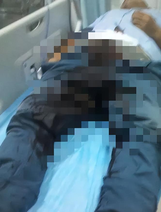 广西一男子被女友切掉生殖器，被救后哭喊：下面太疼，不是男人了