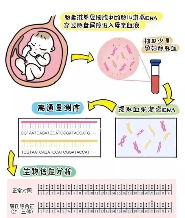 还在纠结唐筛、无创、羊穿怎么选?看这篇就清楚了!
