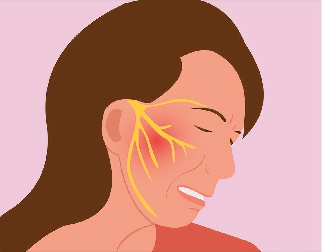 原发性三叉神经痛有治好的吗,原发性三叉神经痛怎么治疗有效