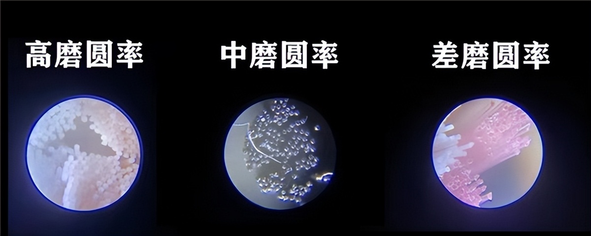 蛀牙有什么注意事项,蛀牙龋坏怎么预防