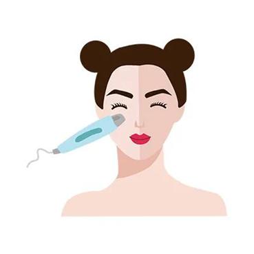 激光祛斑好不好视频,激光祛斑要擦不擦东西