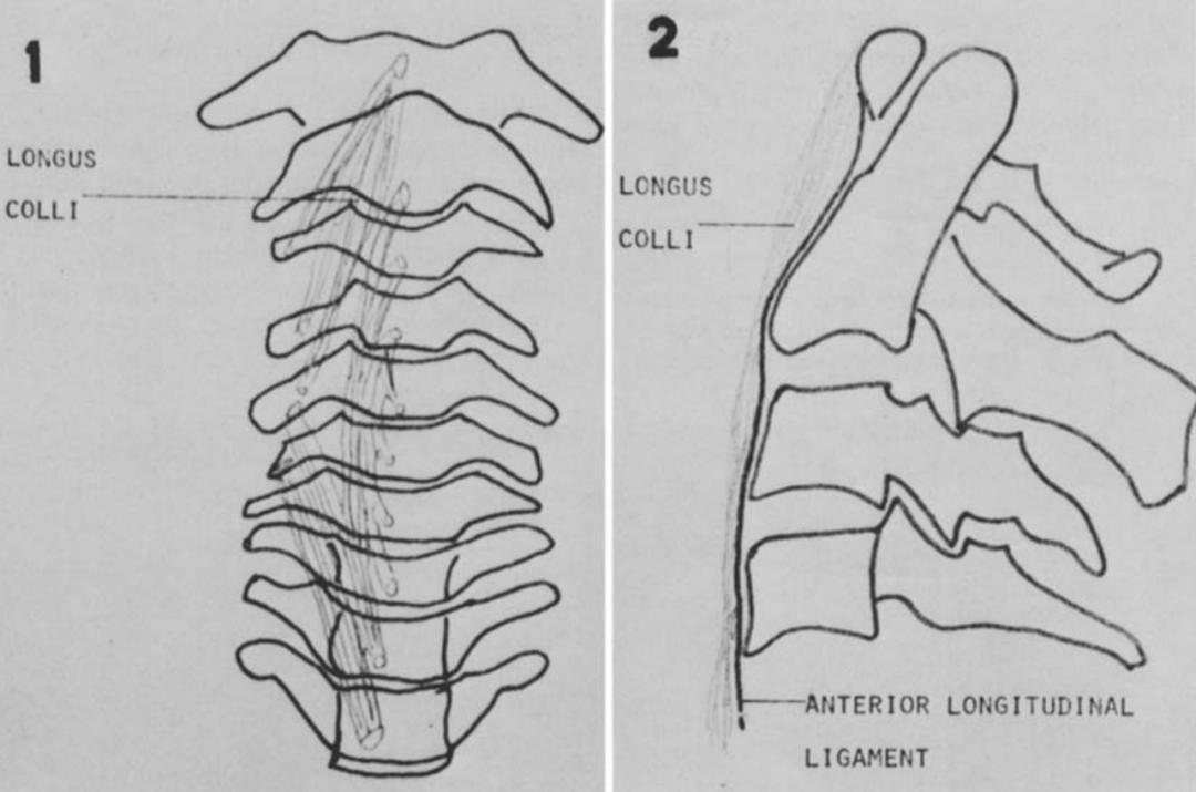 颈长肌腱炎影像表现,三头肌钙化性肌腱炎治疗
