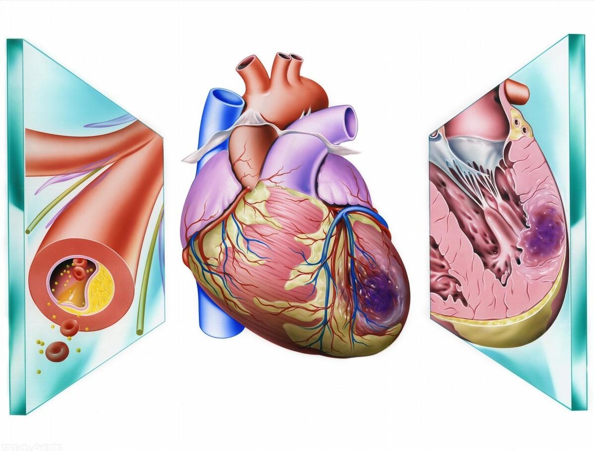 三种药消除血管斑块,三种药降血脂效果好