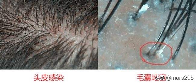 修护受损发质防脱洗发水推荐,防脱头发最好的洗发水