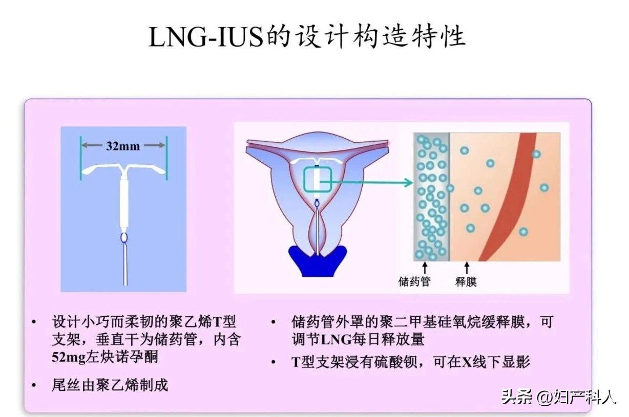曼月乐又名什么,安了一年的曼月乐