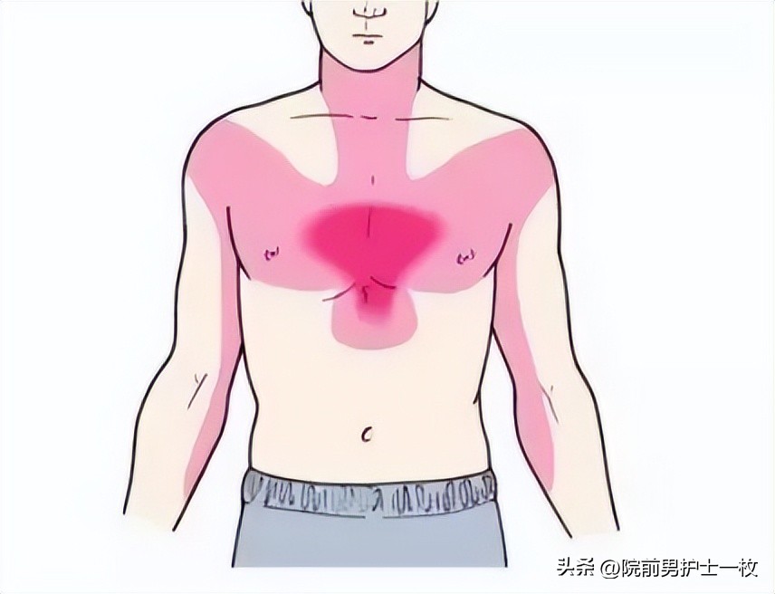 关于心绞痛护理措施的图片,冠心病心绞痛救治成功率