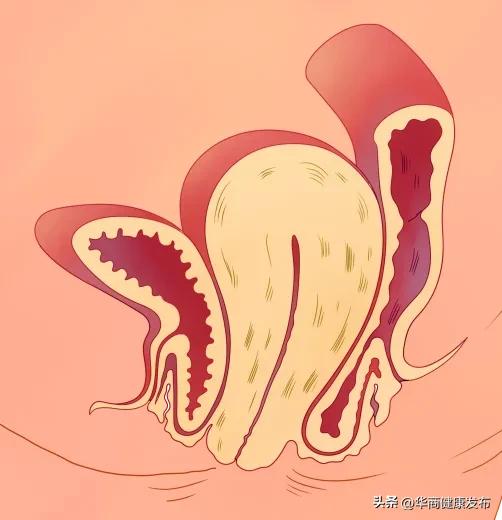 怎么有效抑制皮肉变松,上紧下松有几种方法