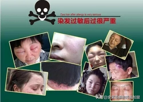 植物染发养发馆投入多少钱呢,植物染发养发馆哪家实力强