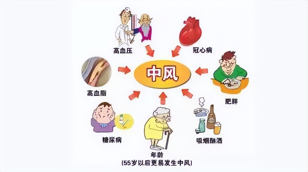 预防脑卒中的优质护理举措,脑卒中的预防分为几级