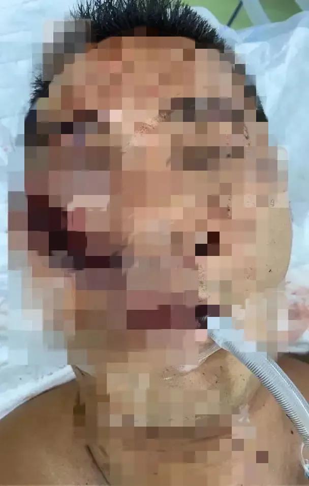 港星黄竣锋被捅伤,对方说认错人了,上次任达华受伤,也说认错了