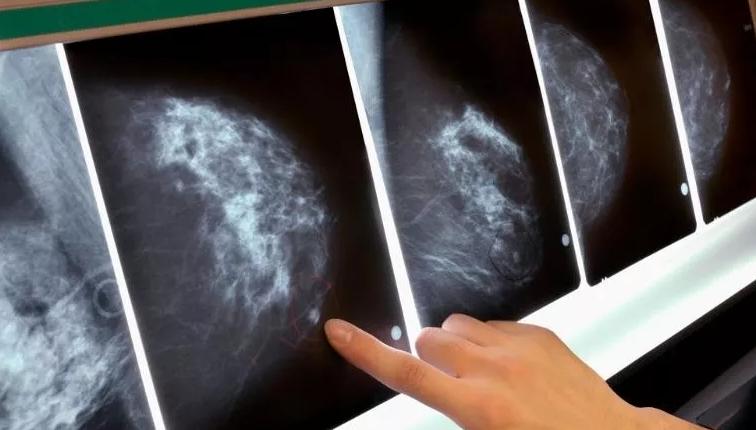 央视曝光市场“夺命毒衣服”，致癌物超标20多倍！可别再乱买了