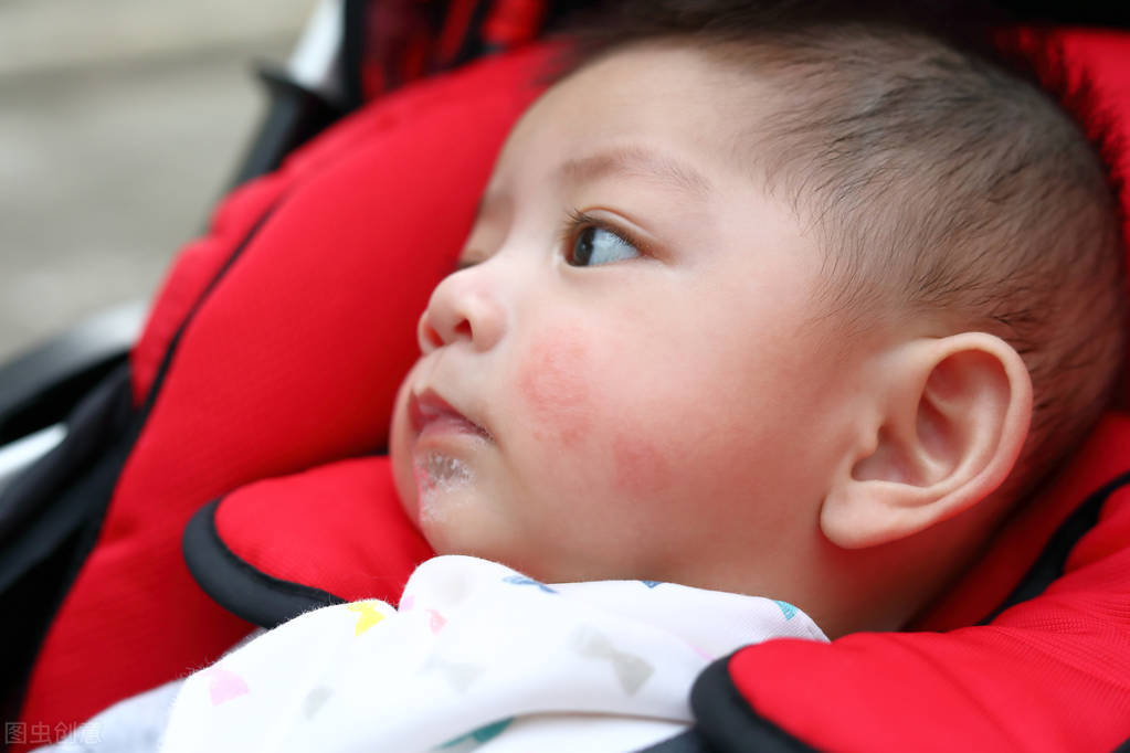 宝宝口周红疹需要抹药膏吗,宝宝口周红疹干燥怎么办