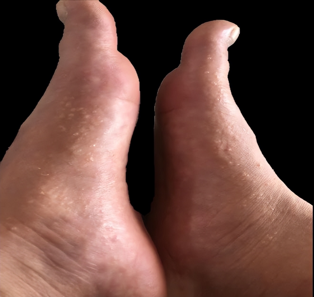 医疗美容和皮肤科的区别,医疗美容与微整形