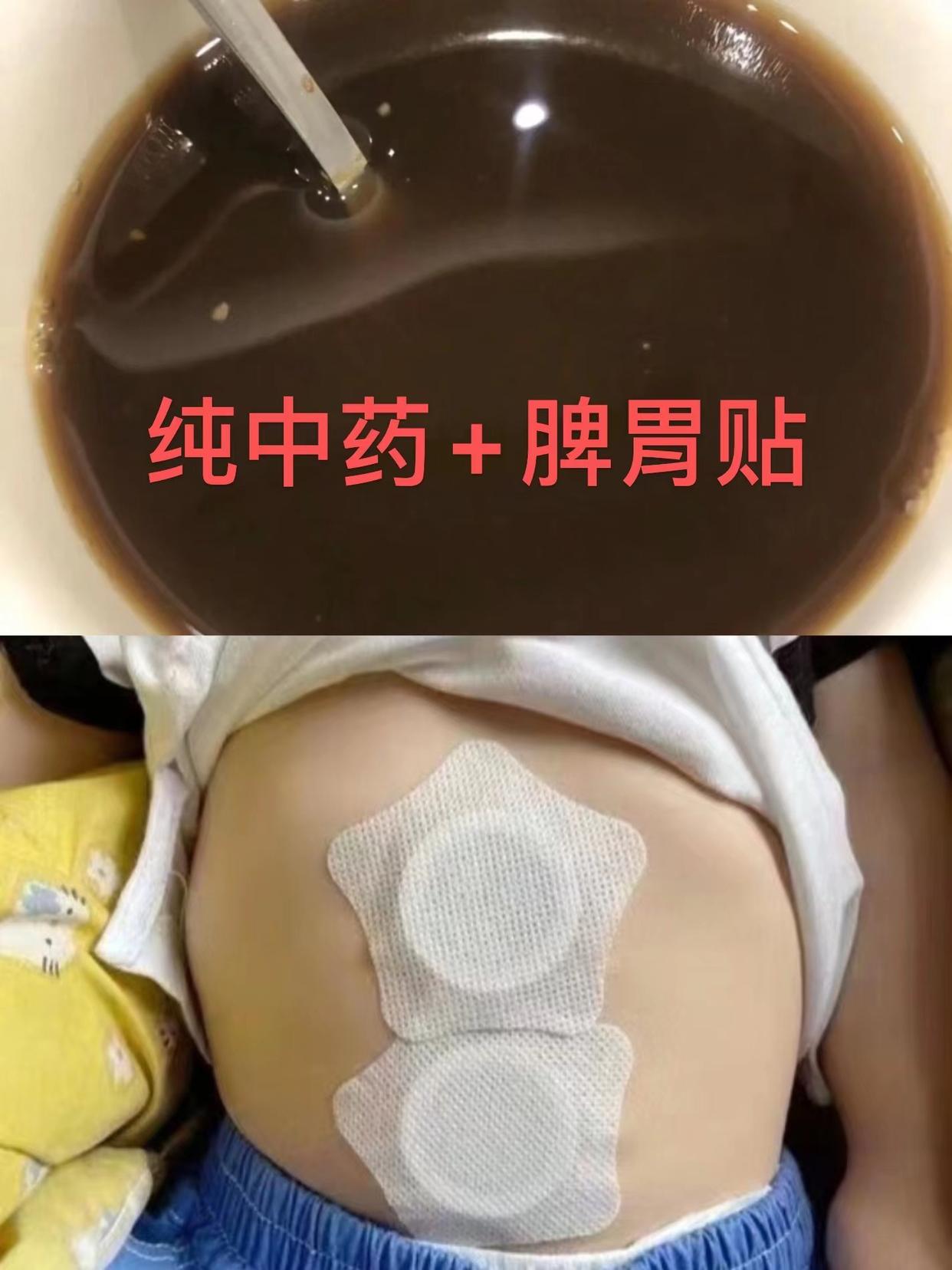 孩子腺样体肥大鼻塞调理脾胃的药,腺样体肥大14岁中医调理