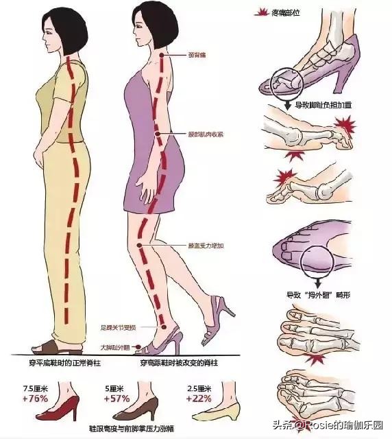 小腿外翻大腿凸起变直的方法,大腿前侧突出小腿外翻怎么瘦最快
