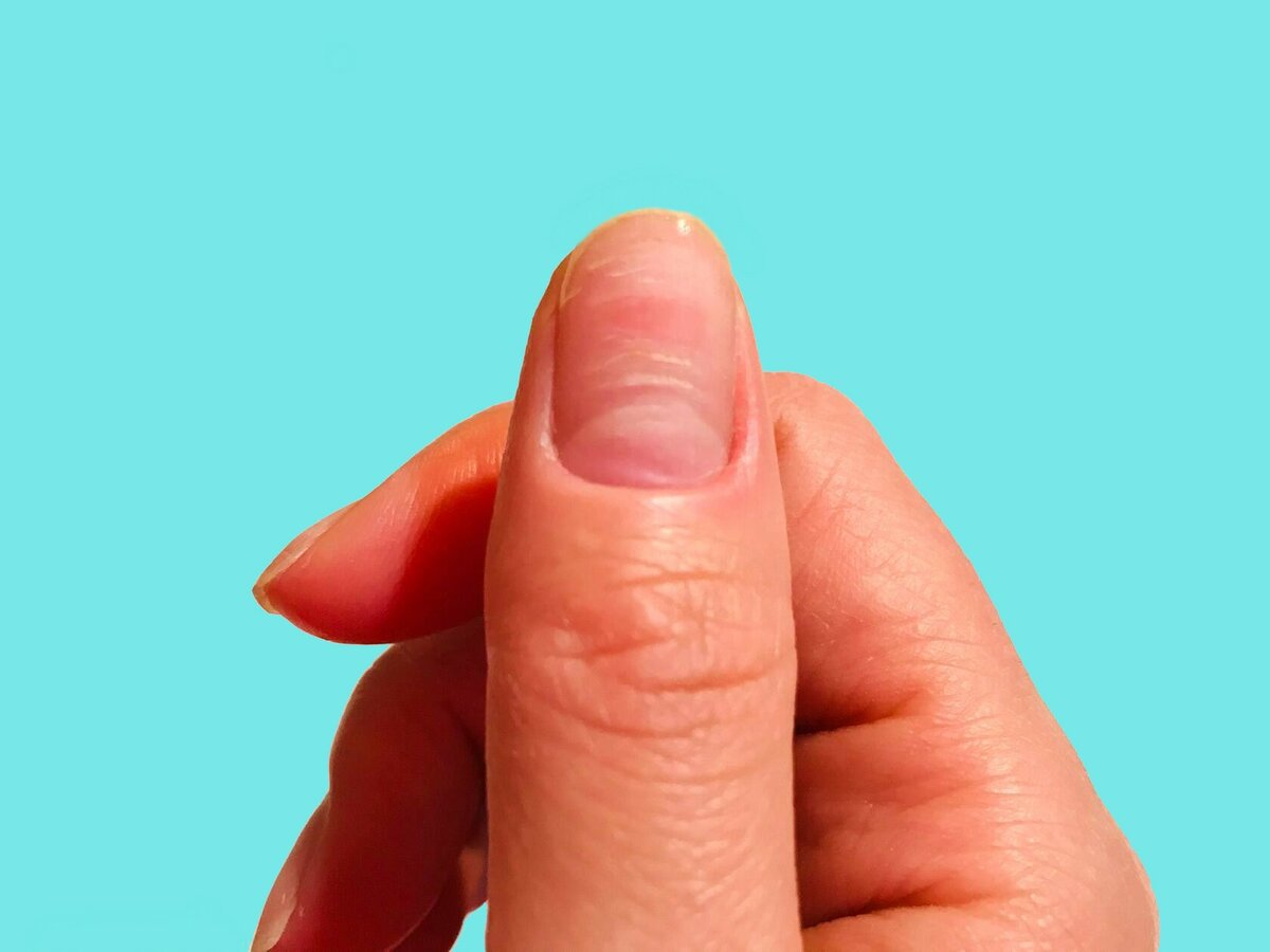 指甲有凹凸的波浪纹是什么原因,指甲渐变有条纹怎么解决