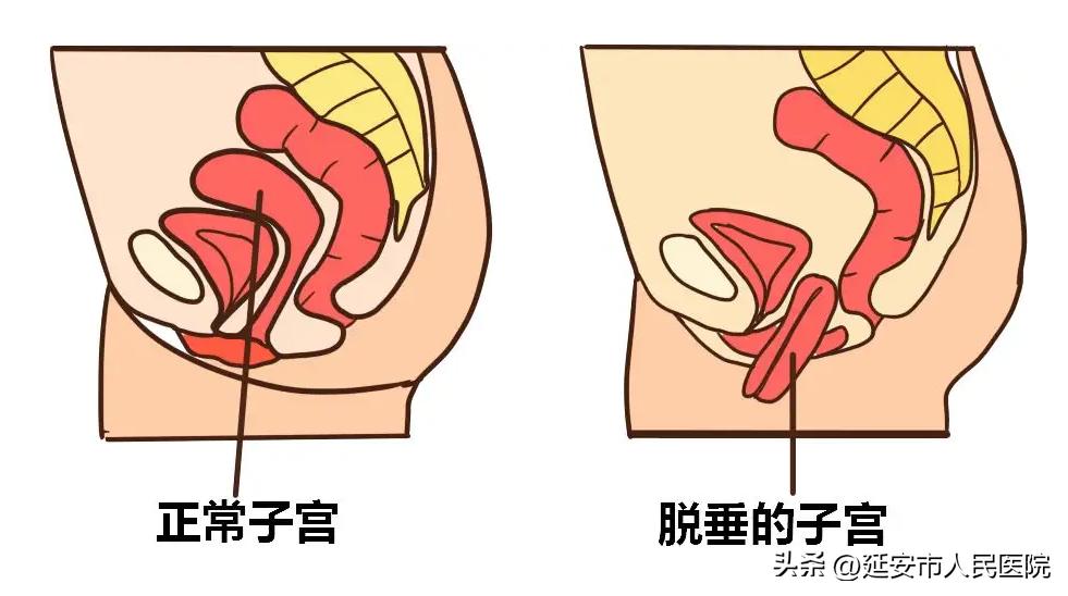 延安市人民医院妇产科二病区病房,延安市人民医院妇产科二病区