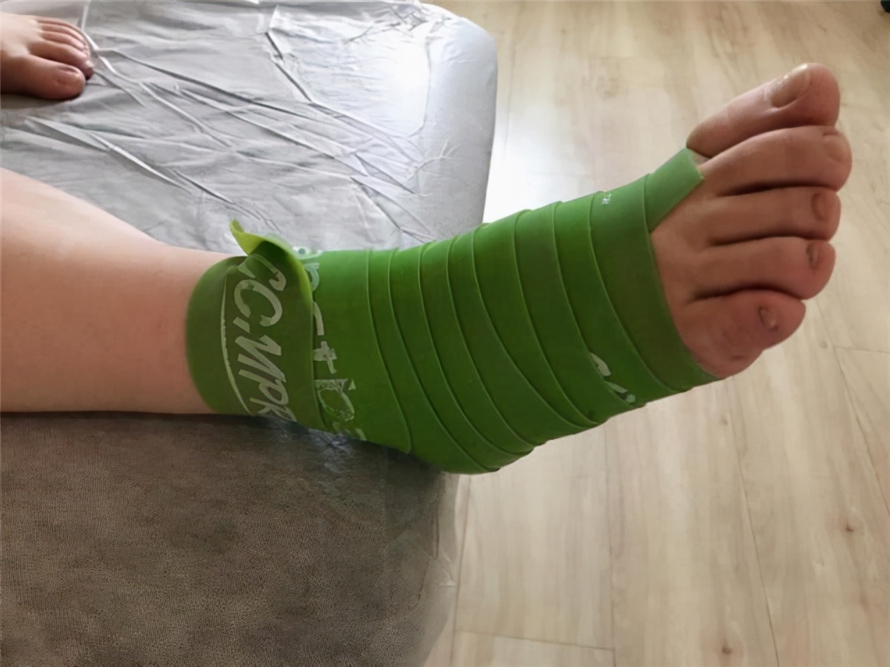 被公认五种最疼的手术，很多人或经历过，不妨提前了解一下