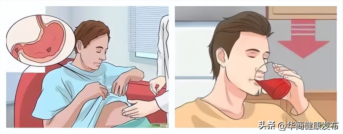 消化系统科普小知识,消化不良科普知识宣传