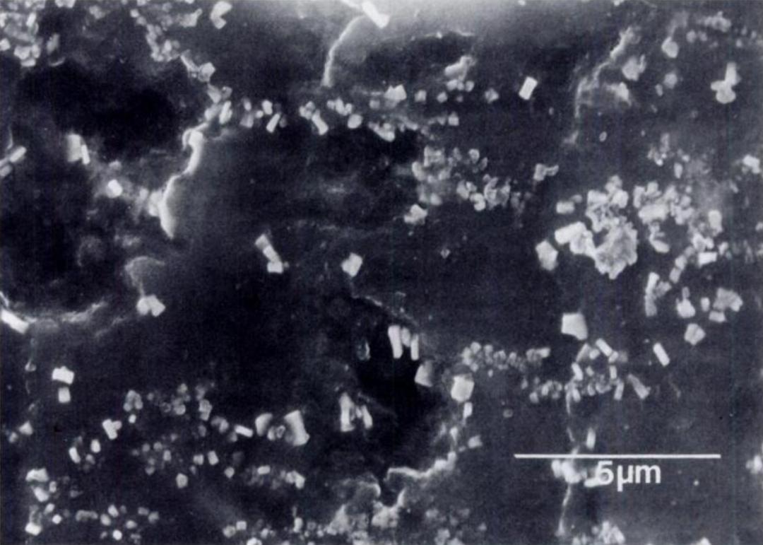 颈椎常见病变图片,颈椎严重的病例