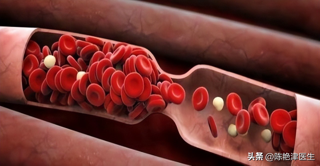 血压中低压高原因与措施,血压低压偏高的原因和解决方法