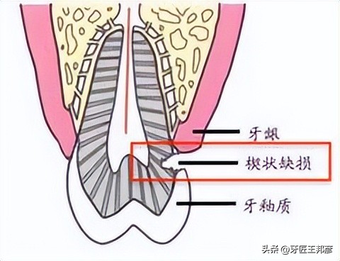 你们六一儿童节送什么给小朋友吗,六一儿童节到了给孩子能送点什么